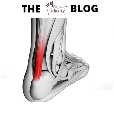 Heel pain image